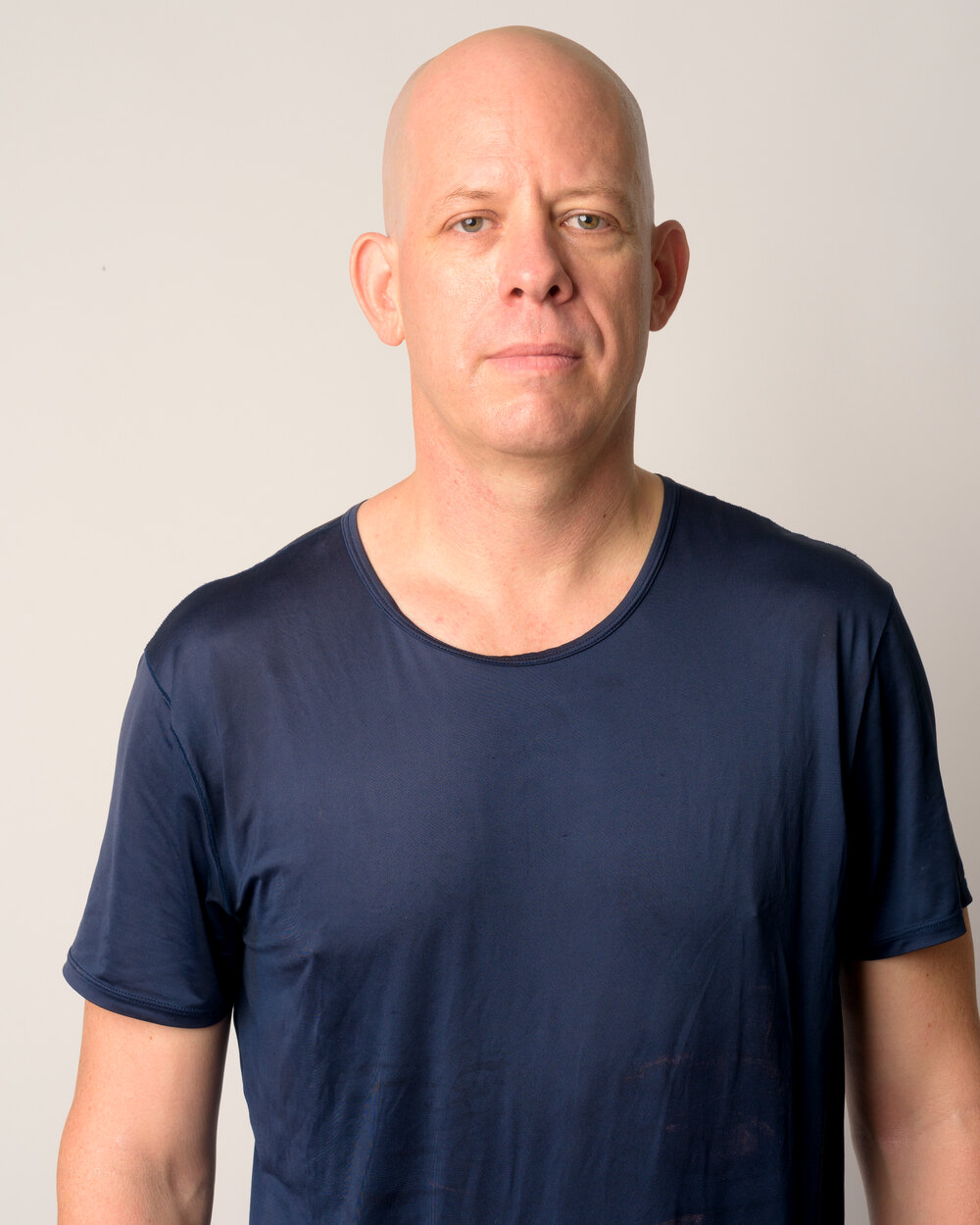 Scalp Micropigmentation